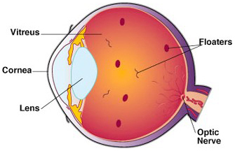 floaters flashes New Jersey eye doctor